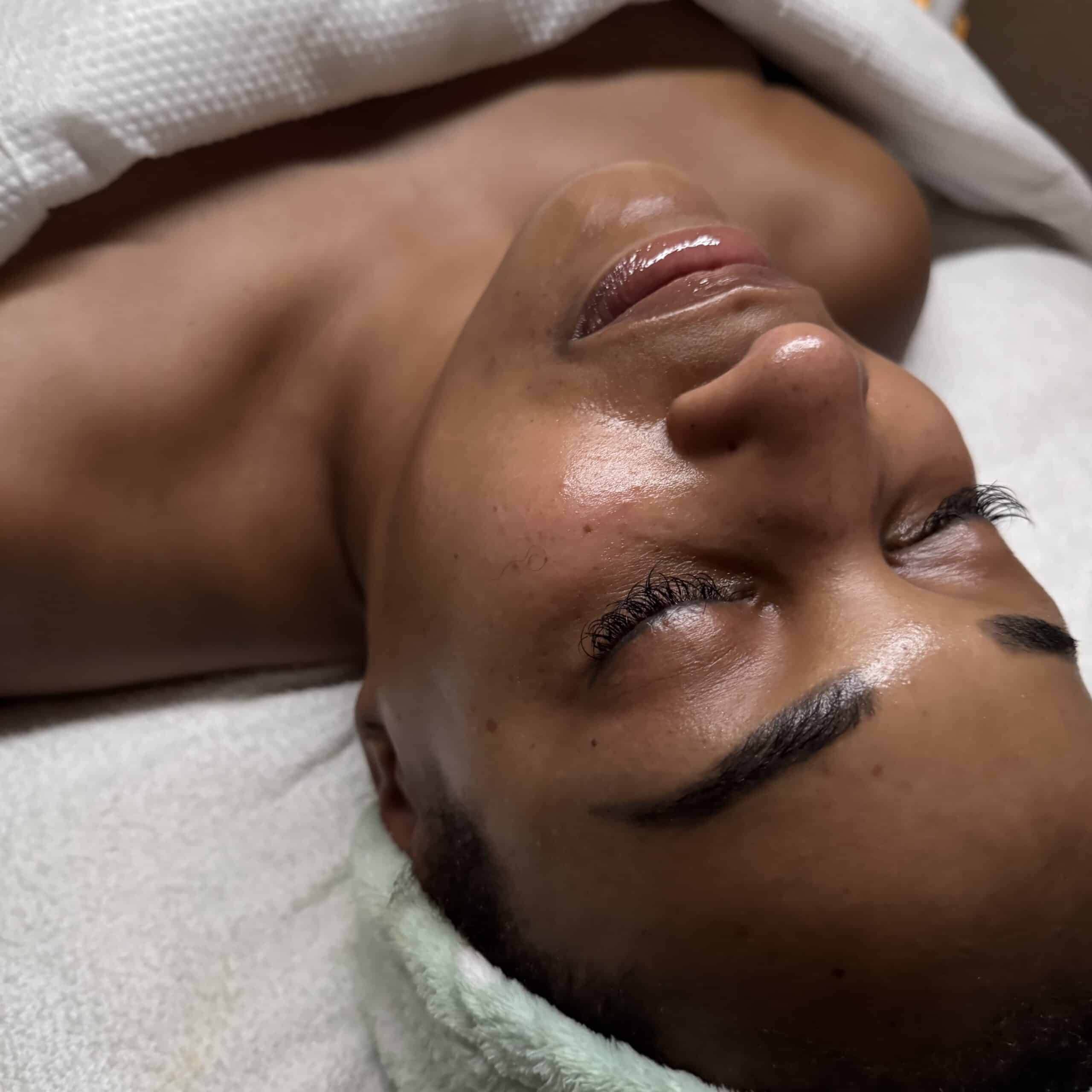 Glowy huid na een dermaplaning behandeling